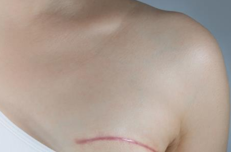 Oncologic Reconstruction